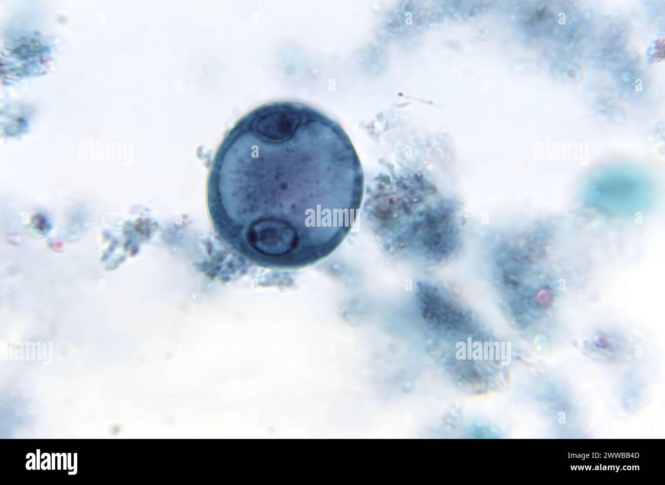 Under 1150X magnification, this photomicrograph of a trichrome stained specimen revealed the presence of an immature, parasitic, binucleate cyst. Stock Photo