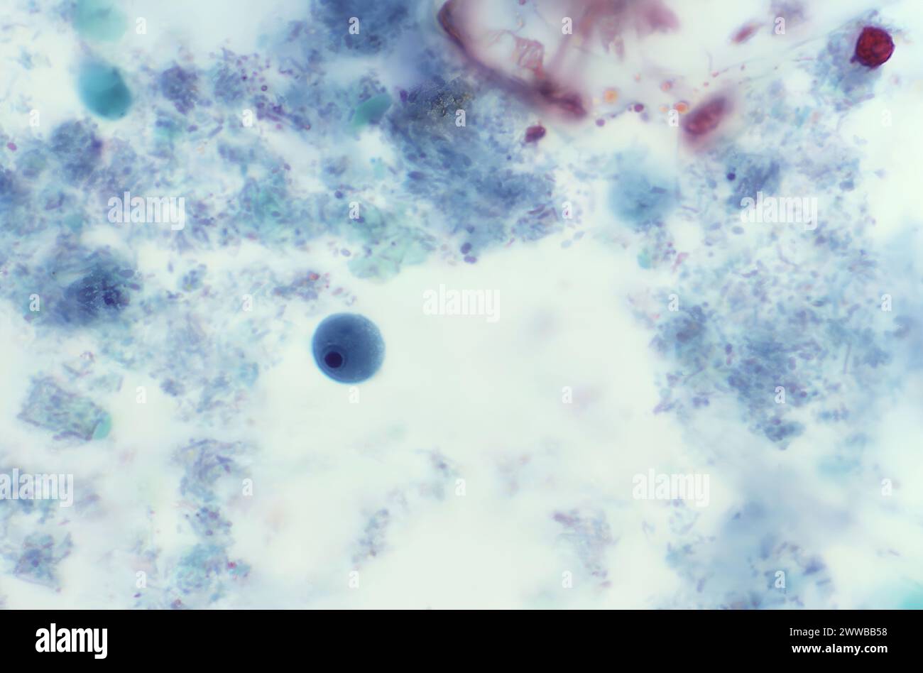 This photomicrograph of a trichrome-stained specimen revealed the ...
