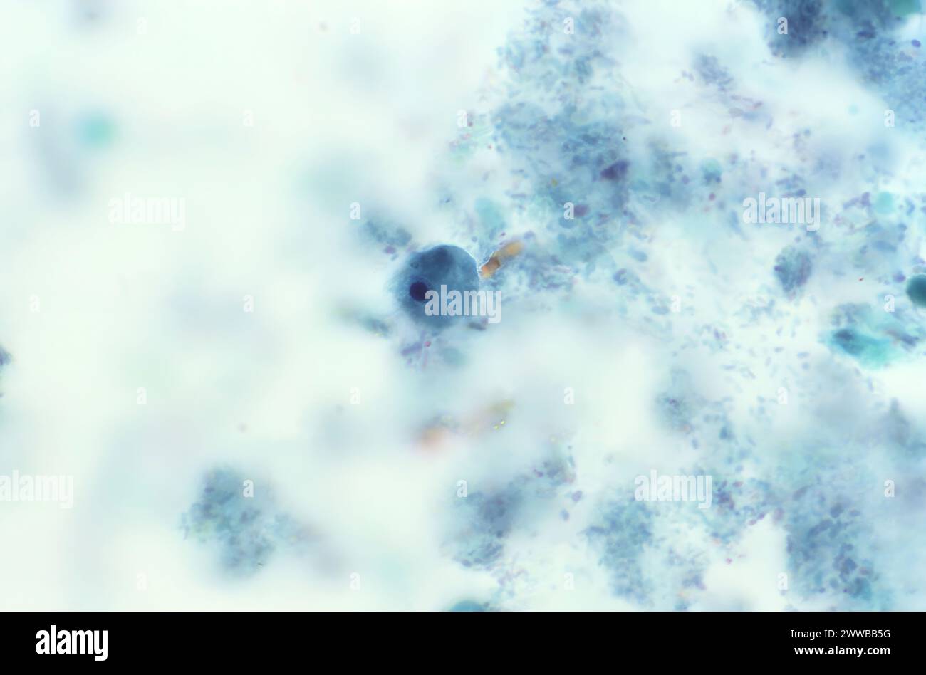This photomicrograph of a trichrome-stained specimen revealed the ...