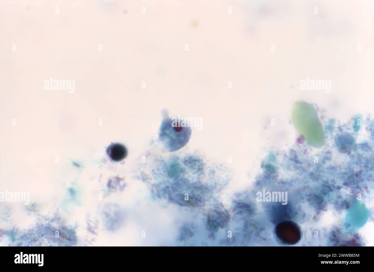 This photomicrograph of a trichrome-stained specimen revealed the ...