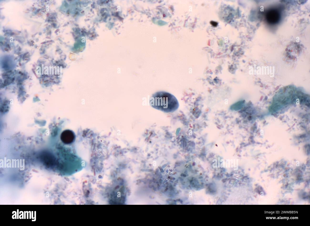 This photomicrograph of a trichrome-stained specimen revealed the ...