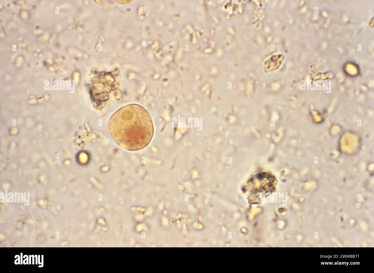 This photomicrograph of an iodine-stained specimen revealed a single ...