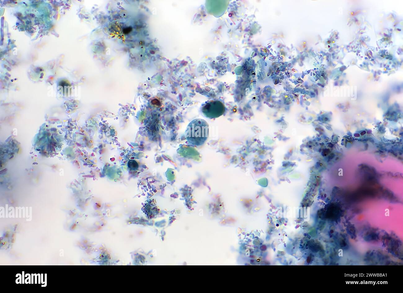 This photomicrograph of a trichrome stained specimen, revealed the presence of a nonpathogenic intestinal amoeba, Endolimax nana cyst. Stock Photo