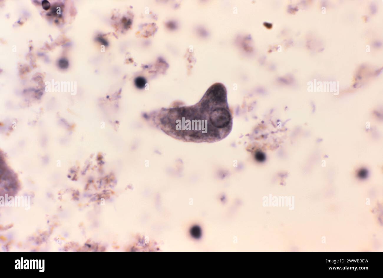 This photomicrograph of an iron hematoxylin stained specimen revealed the presence of a parasitic trophozoite, Entamoeba histolytica. Stock Photo