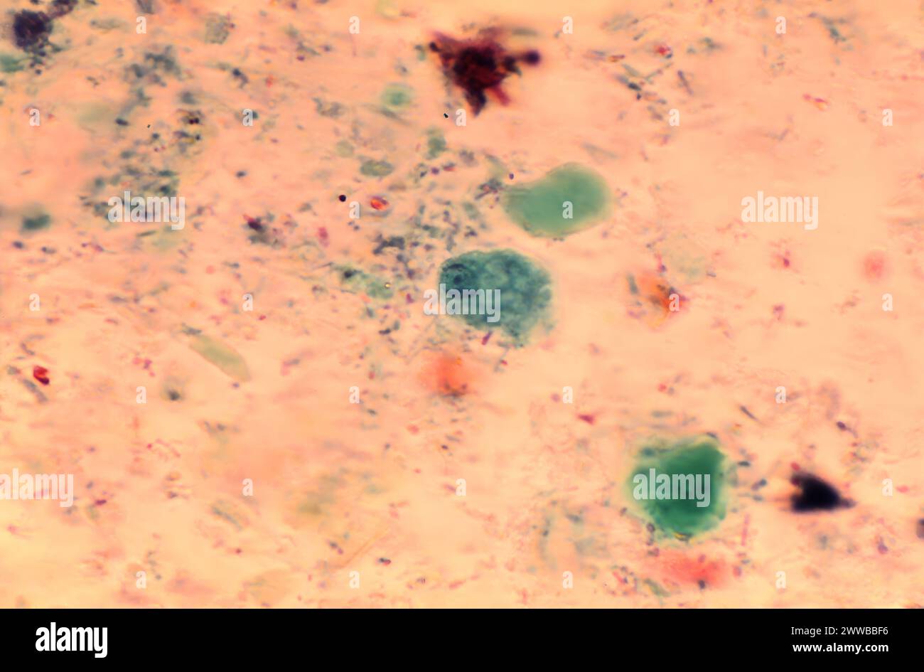 This photomicrograph of a specimen stained with Wheatleys trichrome ...