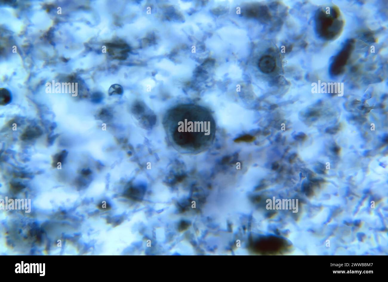 Under 900X magnification, this photomicrograph revealed the presence of ...