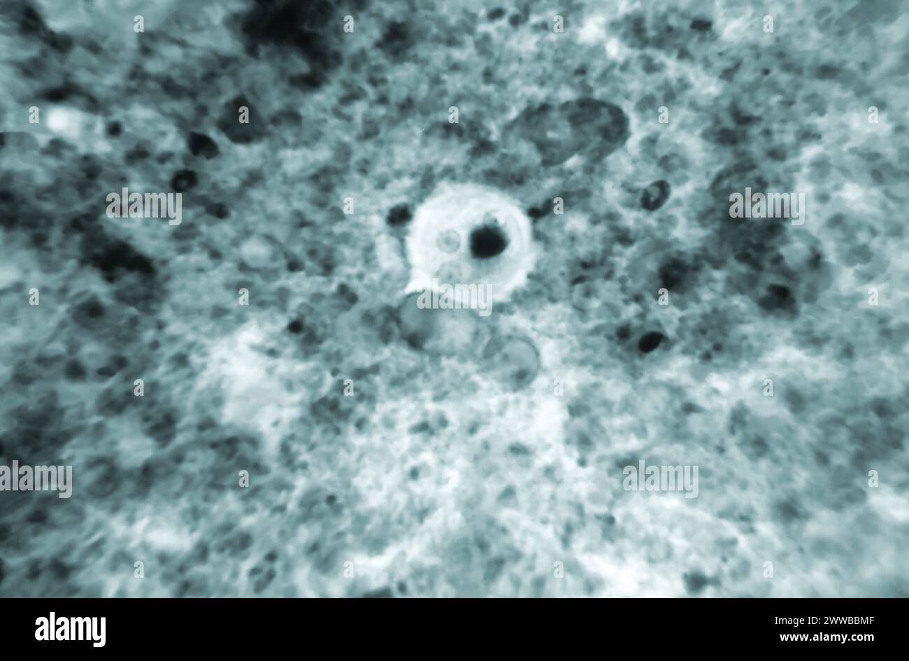 Under 900X magnification, this photomicrograph of a chorazole black ...