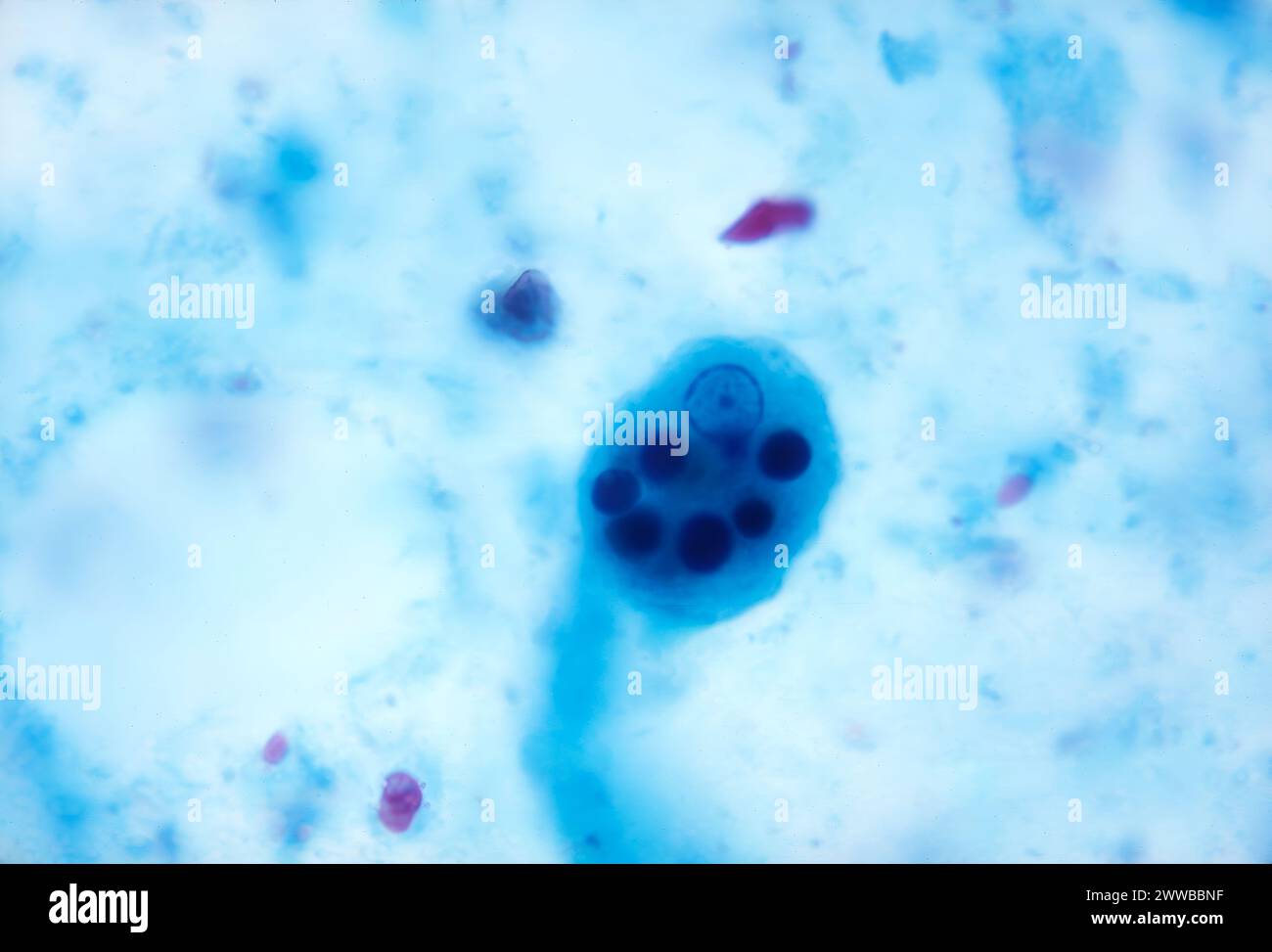 This photomicrograph depicts an Entamoeba histolytica parasitic trophozoite. Stock Photo