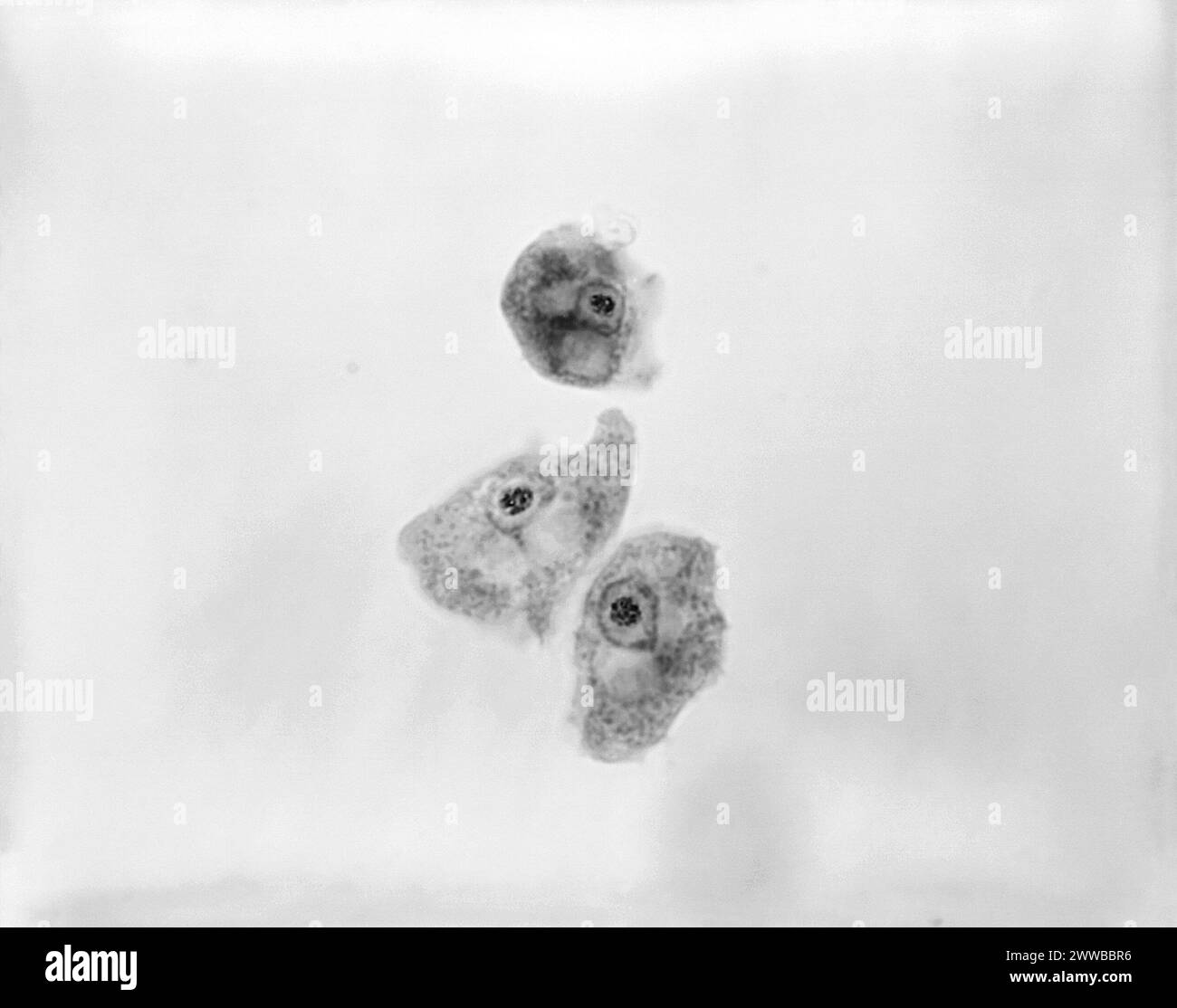 This 1973 photomicrograph depicts three Naegleria gruberi, free-living amoebae. CDC/Dr George Healy 1973. Stock Photo