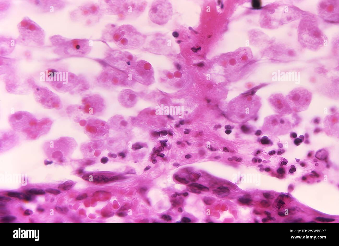 Under a magnification of 500X, this photomicrograph of a sample of intestinal mucosa. Stock Photo