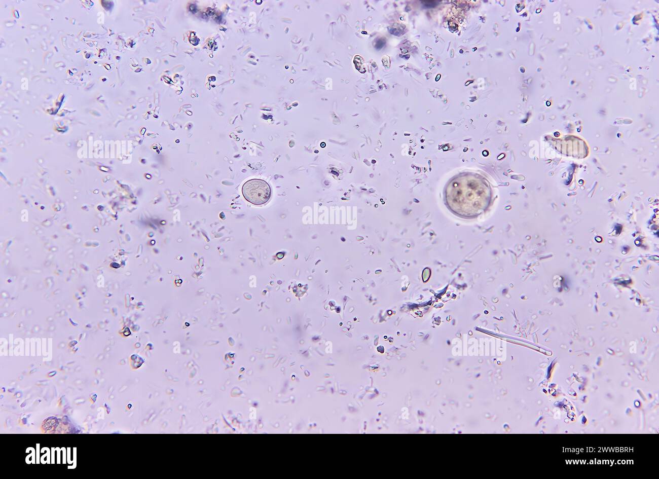 This photomicrograph of an unstained direct mount specimen depicts an Entamoeba coli parasitic amoebic cyst, which contained multiple nuclei. CDC/Dr. Stock Photo