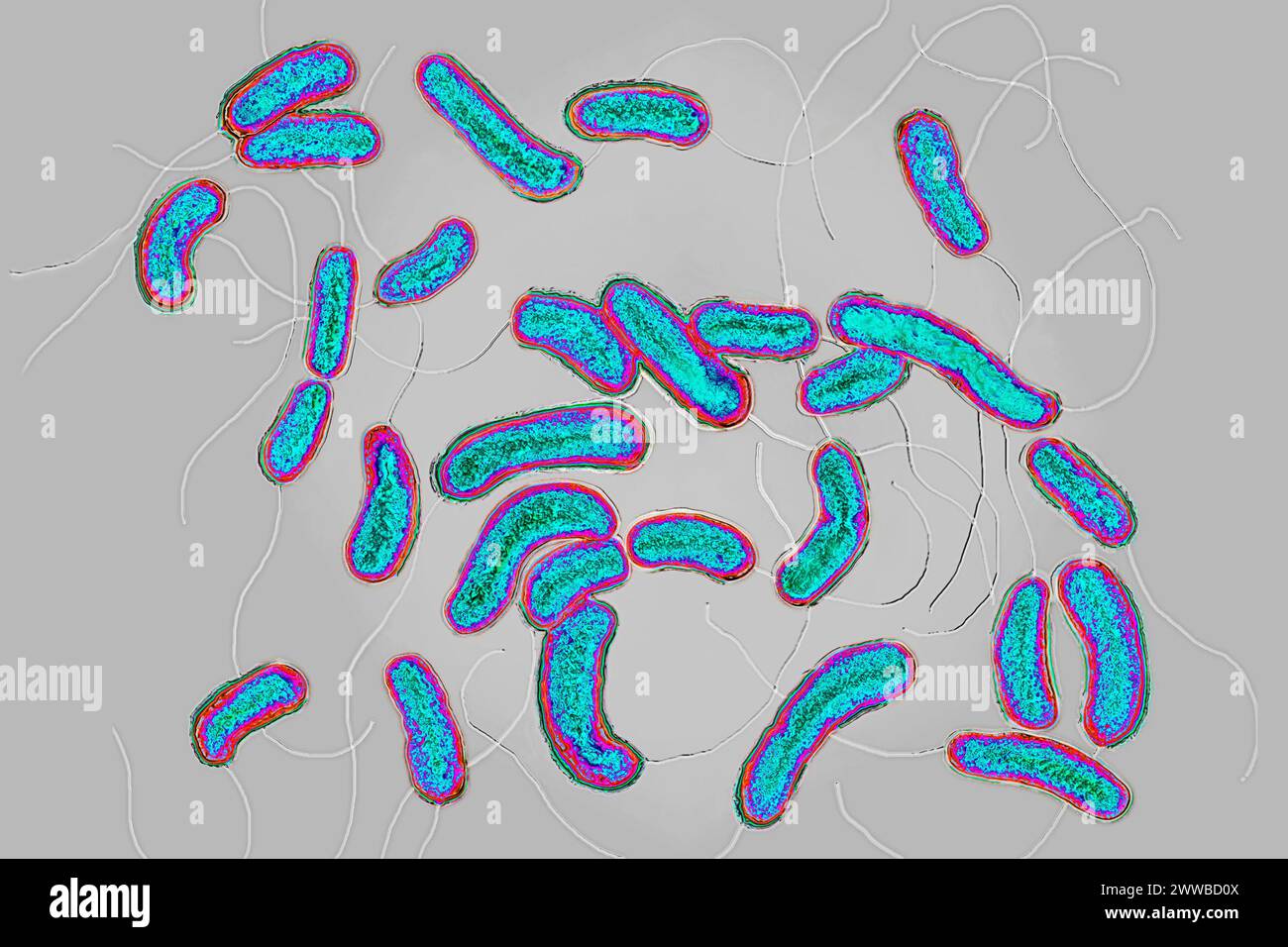 Cholera bacilli or cholera vibrio (Vibrio cholerae). Cholera is a
