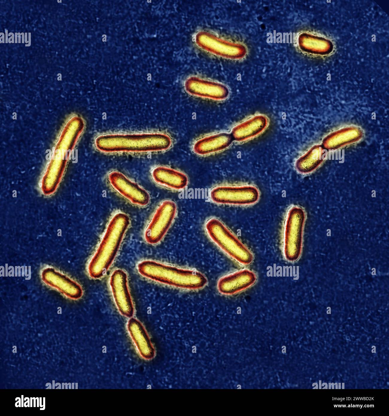 Pseudomonas aeruginosa or pyocyanin bacillus, pathogenic bacteria, very resistant and often responsible for nosocomial infections. Stock Photo
