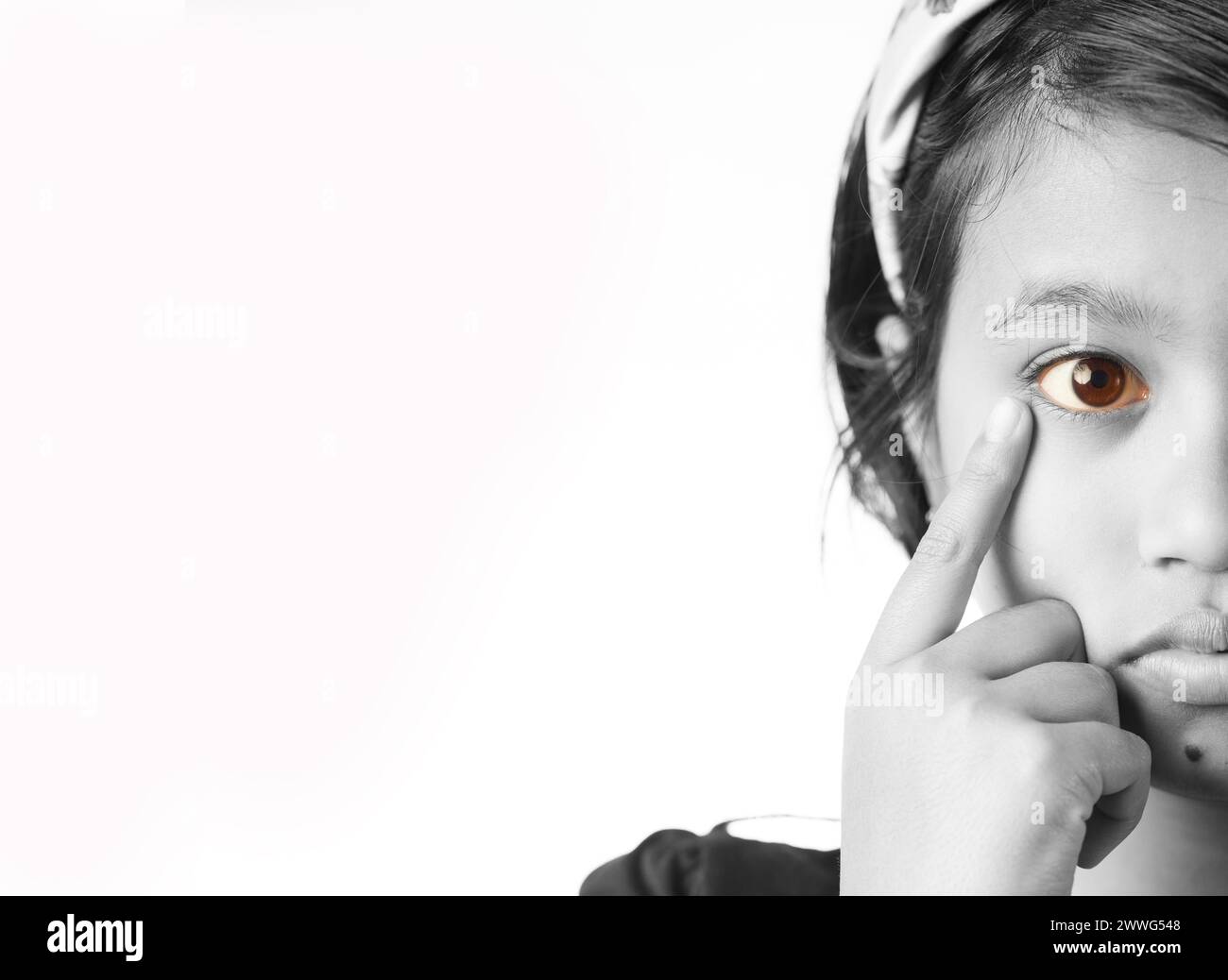 Close up monochrome view of yellow reddish eye of an Indian girl child
