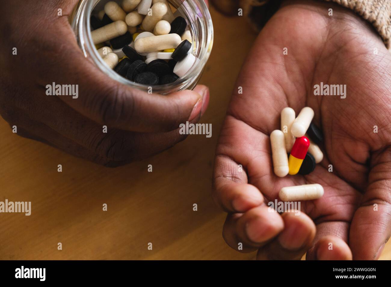 Close-up of the hands of an African man holding various capsules, portraying the daily routine of vitamin and medication consumption. Emphasizes health and wellness. Diverse Supplements in Hand Stock Photo