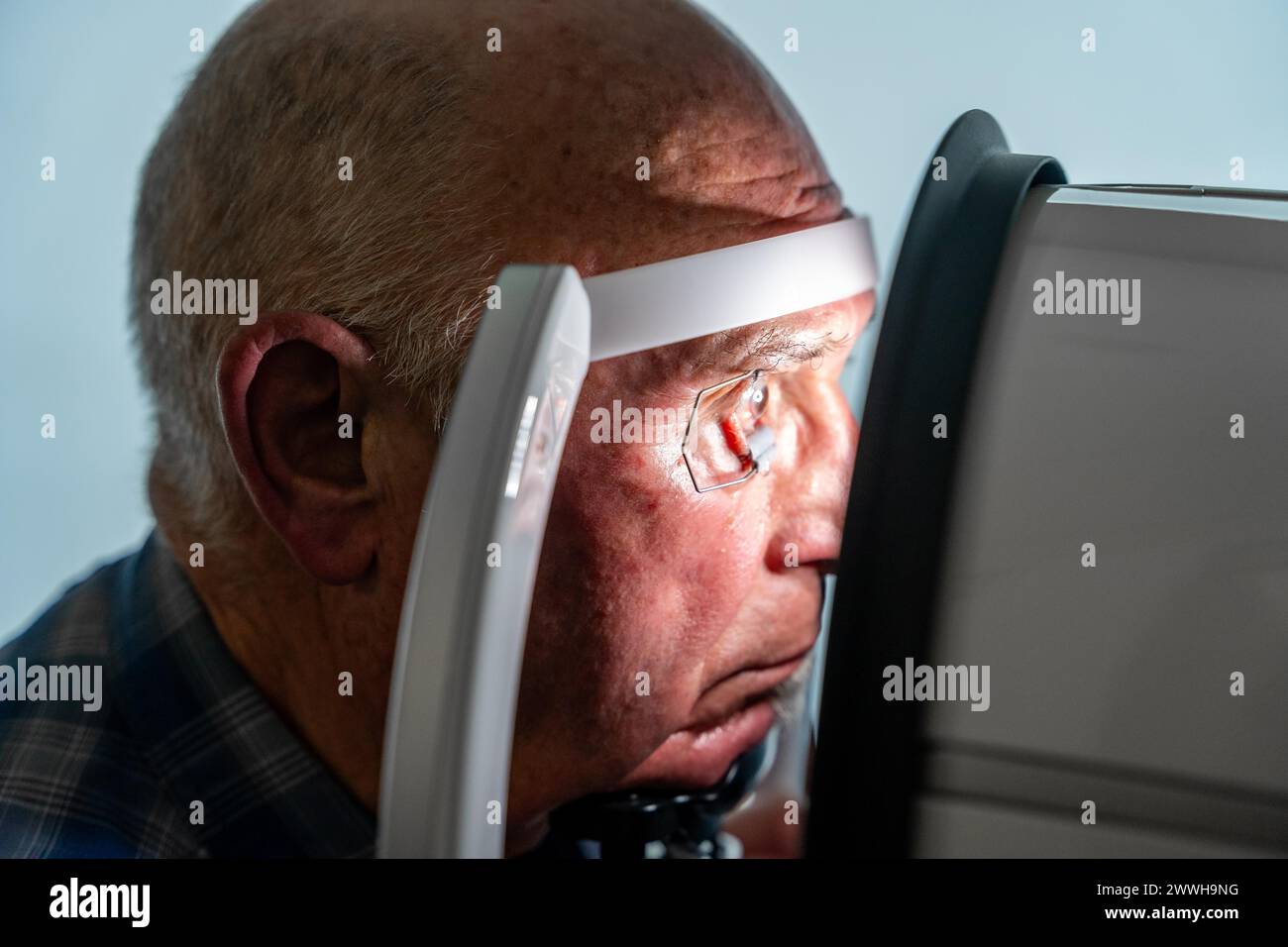 Close-up photo with side view of a senior man with eye opener leaning on front of a innovative machine during a laser treatment for glaucoma Stock Photo
