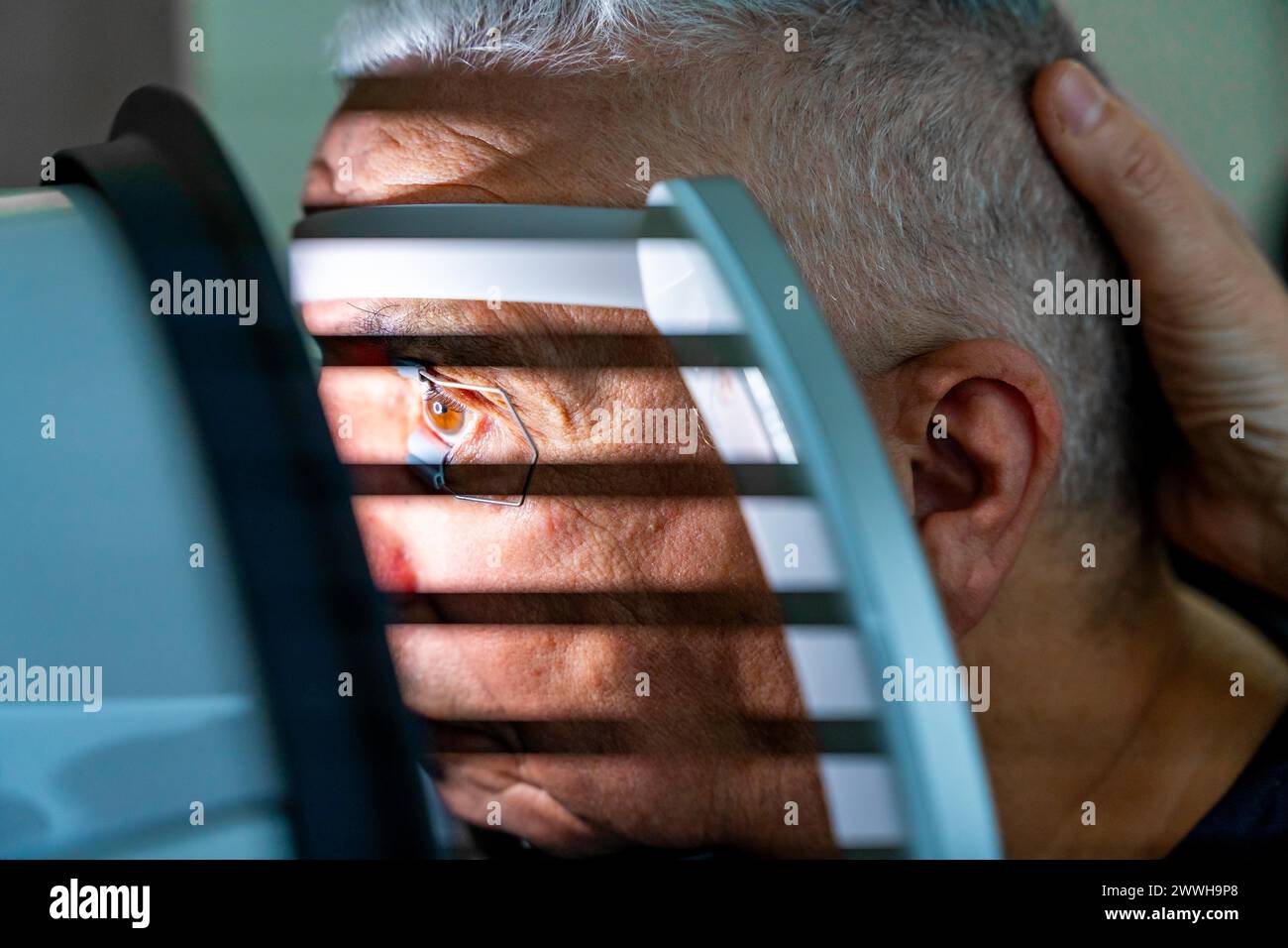 Close-up photo of a senior man receiving a laser treatment for glaucoma in a clinic Stock Photo