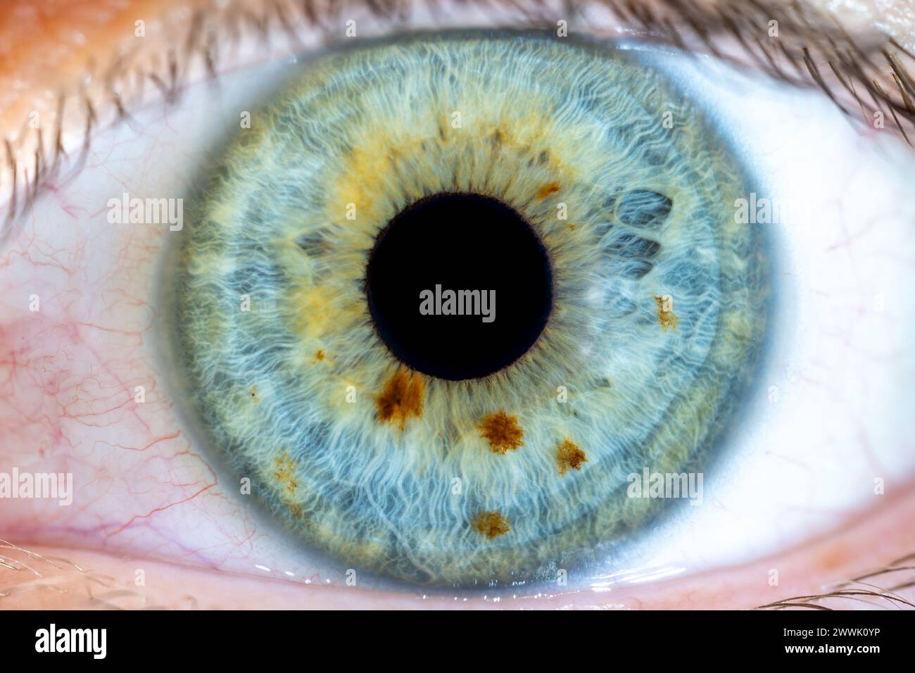 Description: High Resolution Female Green-Blue Colored Eye with Brown Pigment Spots and Pupil Wide Open. Close Up. Structural Anatomy. Human Iris. Mac Stock Photo