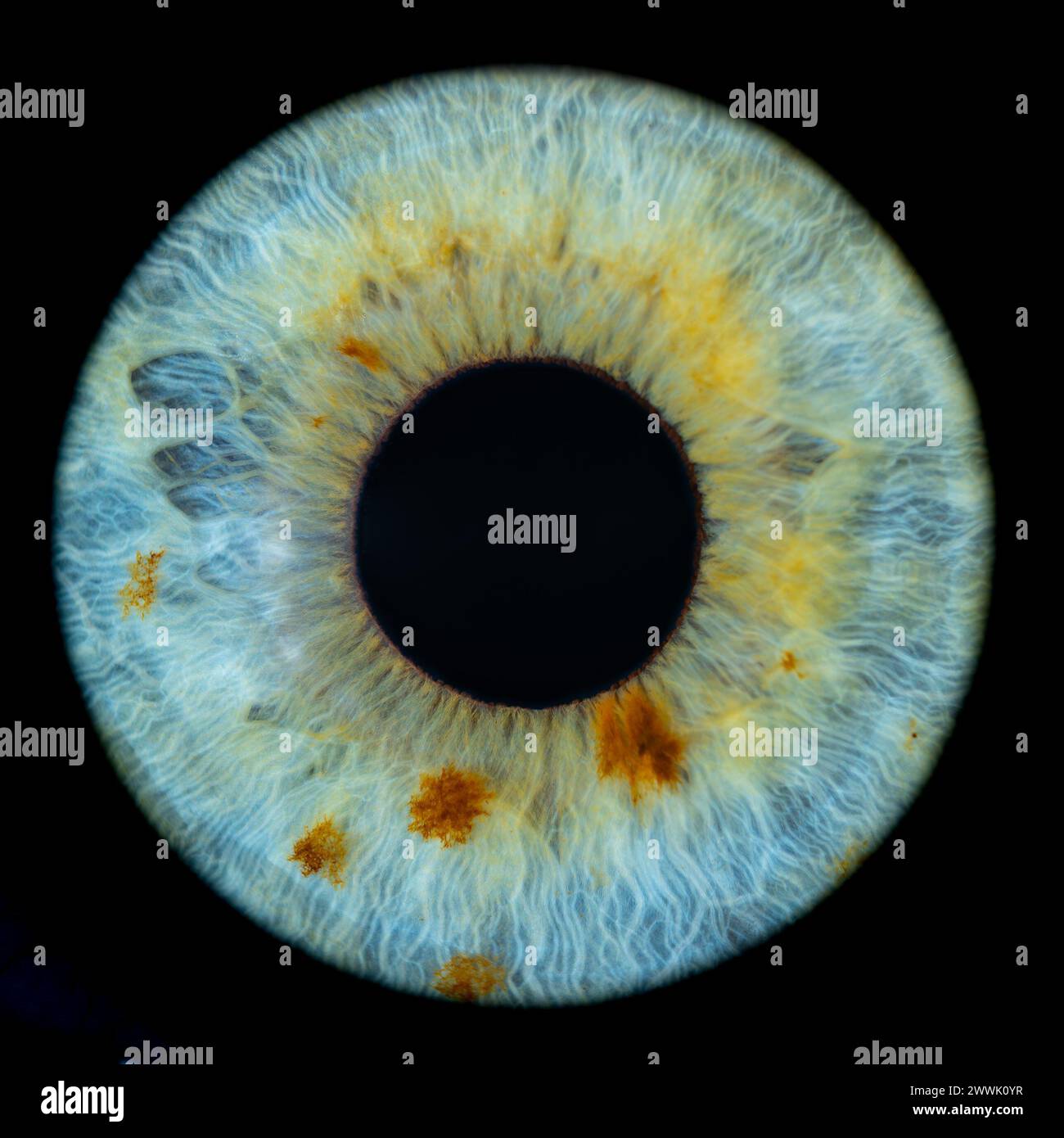 Description: Macro photo of human eye on black background. Close-up of female blue-green colored eye with brown spots. Structural Anatomy. Iris Detail Stock Photo
