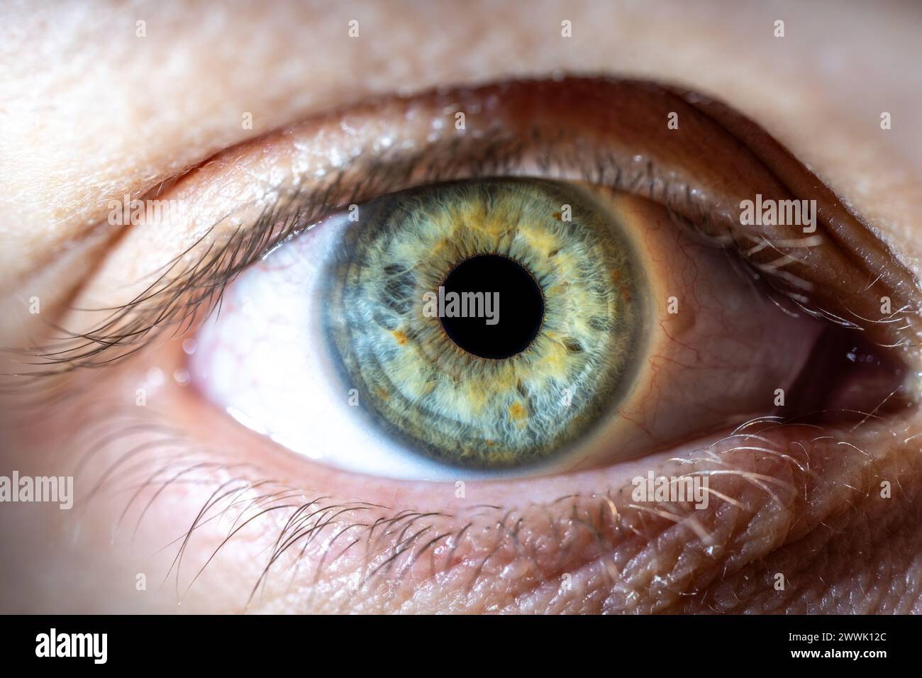 Description: Female Blue-Green Colored Eye with brown pigment spots. Pupil Opened. Close Up. Structural Anatomy. Human Iris Macro Detail. Stock Photo