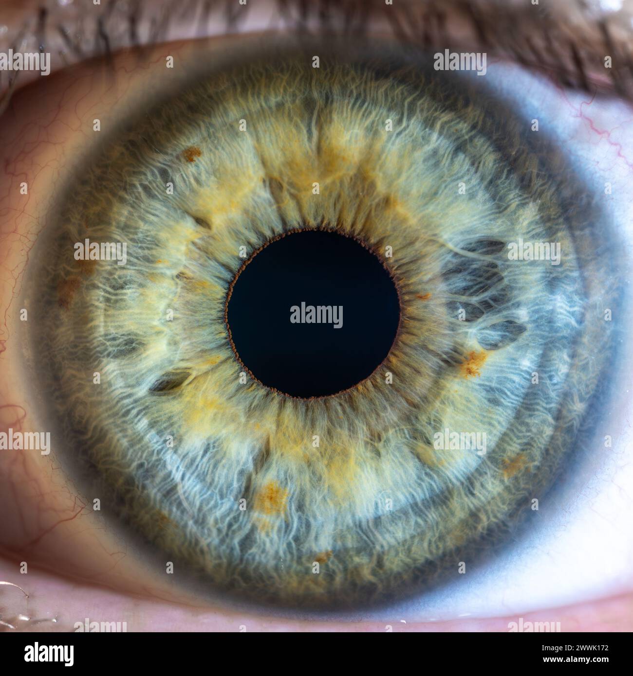 Description: High Resolution Female Green-Blue Colored Eye with Brown Pigment Spots and Pupil Wide Open. Close Up. Structural Anatomy. Human Iris. Mac Stock Photo