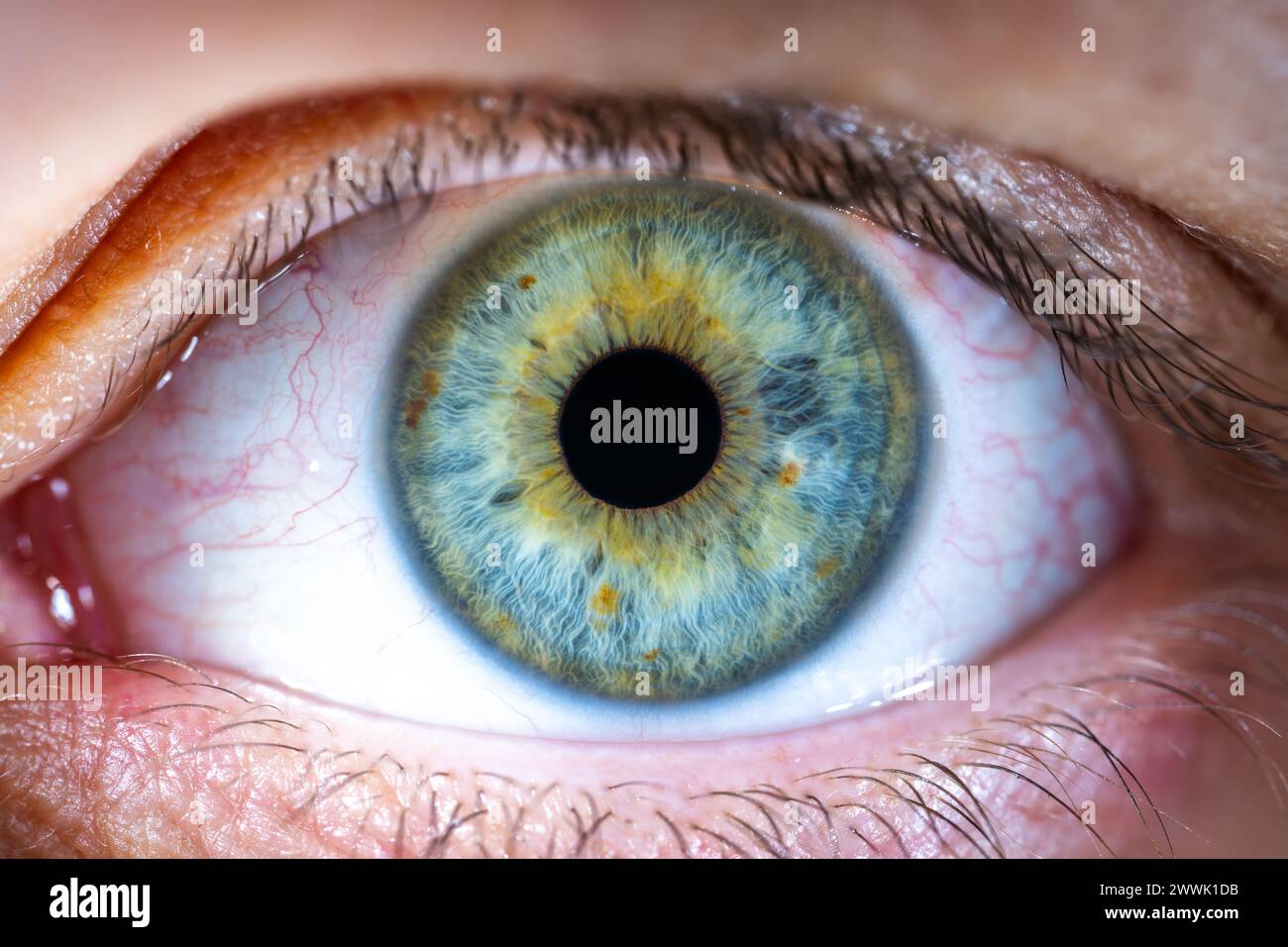Description: Female Blue-Green Colored Eye with brown pigment spots. Pupil Opened. Close Up. Structural Anatomy. Human Iris Macro Detail. Stock Photo