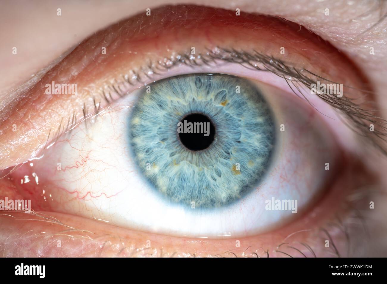 Description: Male Blue Colored Eye with Yellow Pigment Spots and Lashes. Pupil Opened. Close Up. Structural Anatomy. Human Iris Macro Detail. Stock Photo