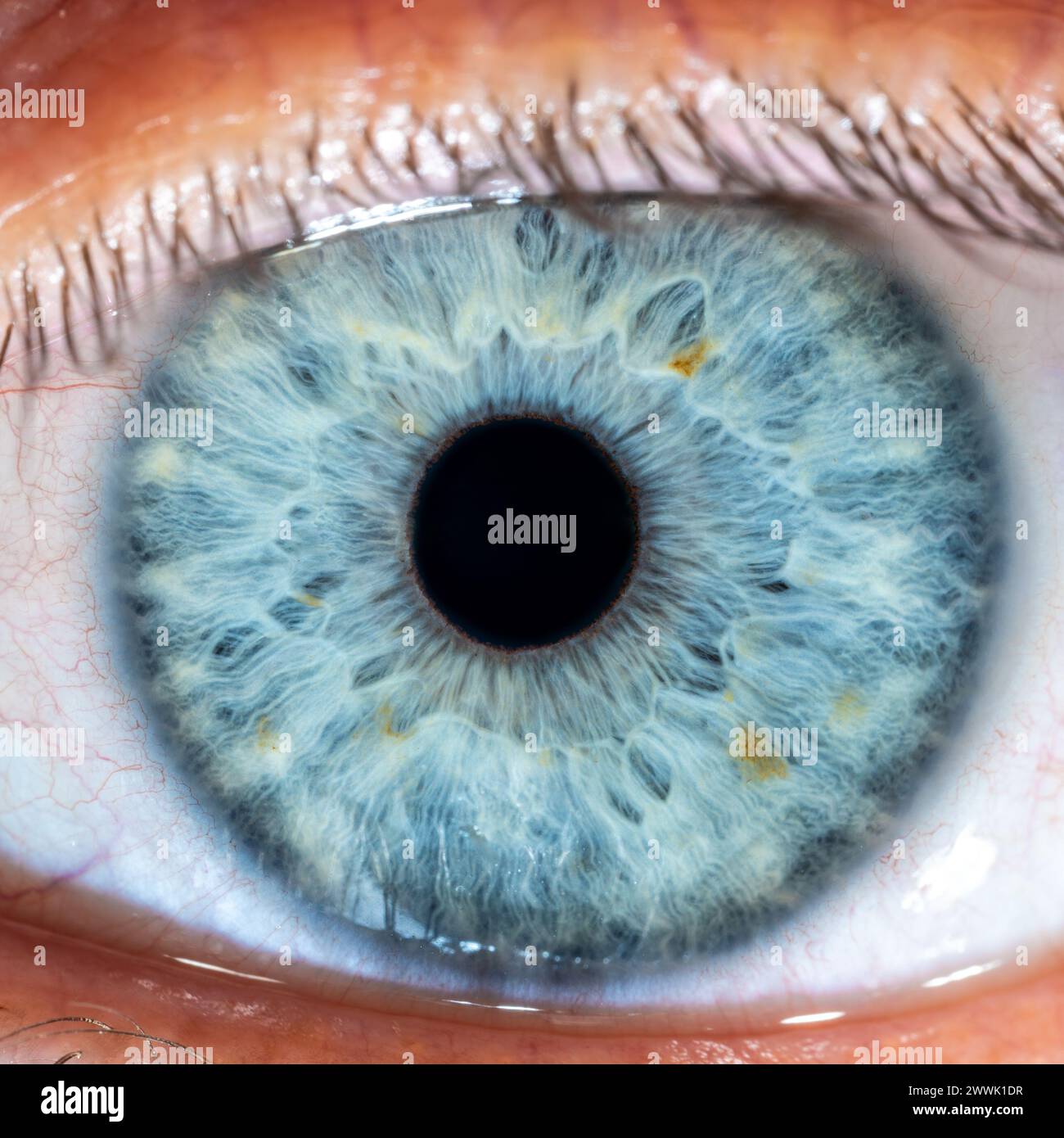 Description: High Resolution male Blue Colored Eye with Yellow Pigment Spots and Pupil Wide Open. Close Up. Structural Anatomy. Human Iris. Macro Deta Stock Photo