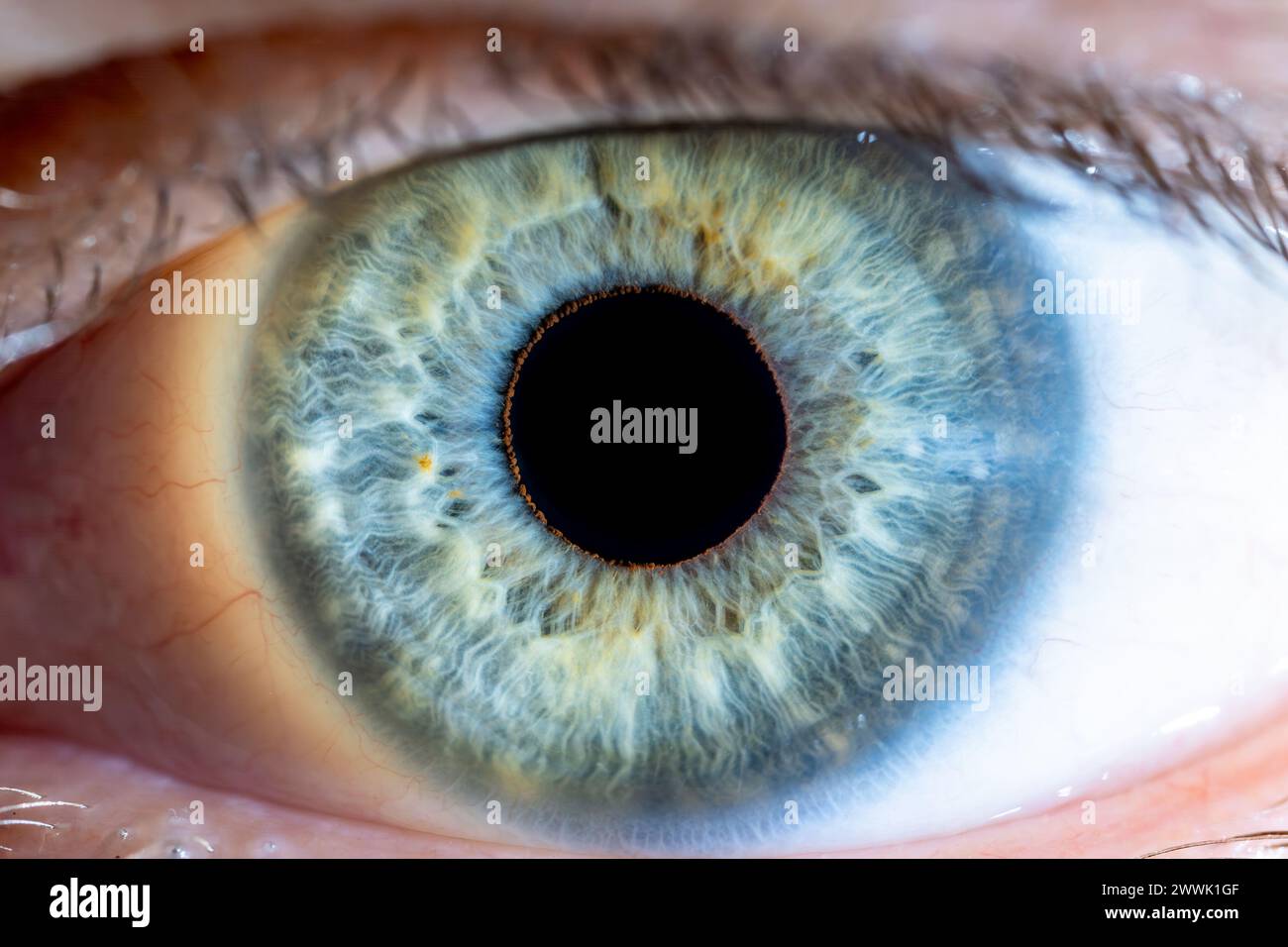 Description: High Resolution male Green-Blue Colored Eye with Yellow Pigment Spots and Pupil Wide Open. Close Up. Structural Anatomy. Human Iris. Macr Stock Photo