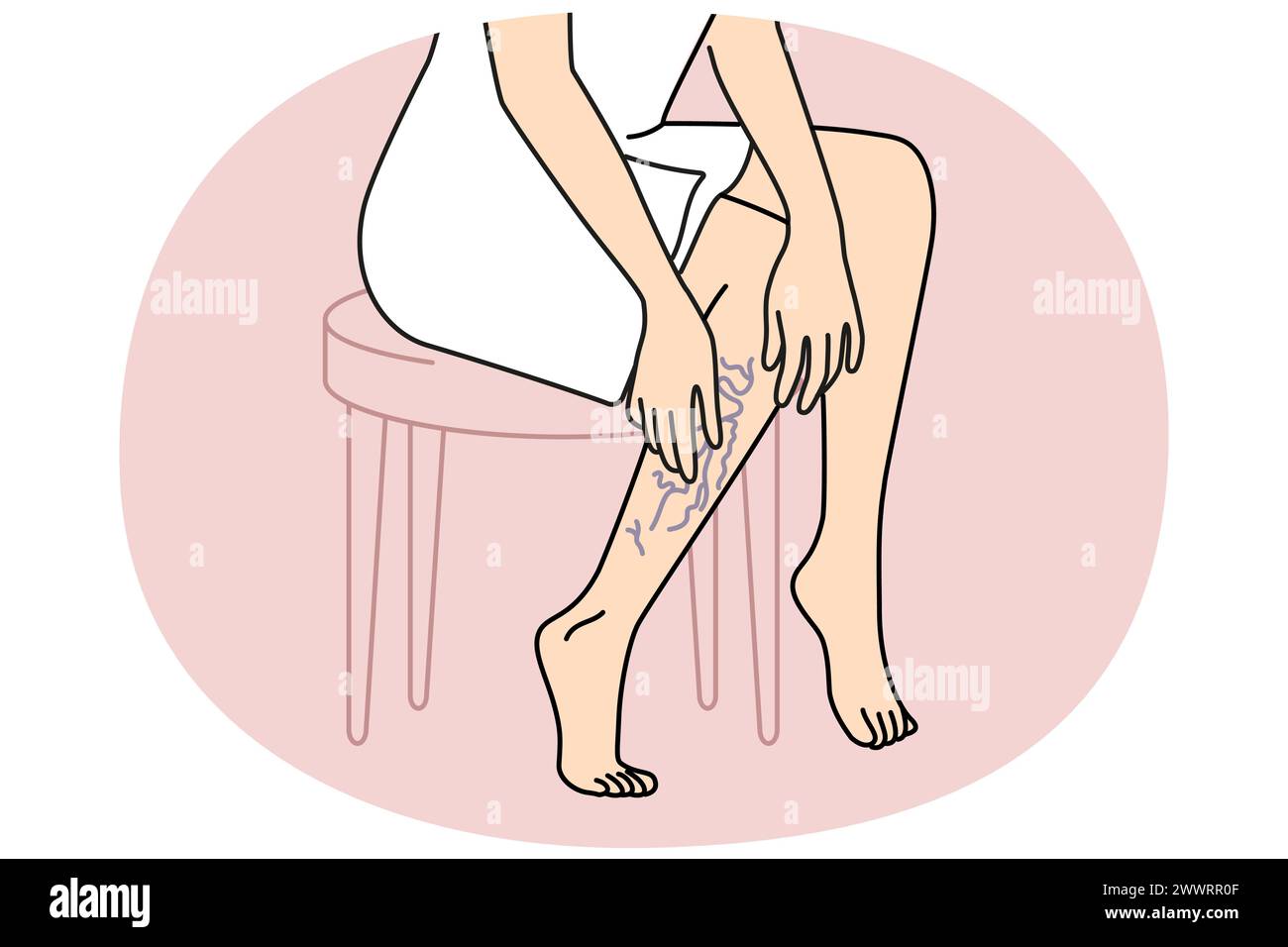 Woman touching legs with varicose veins. Female with vascular leg disease suffer from enlarged blood vessels. Vector illustration. Stock Vector