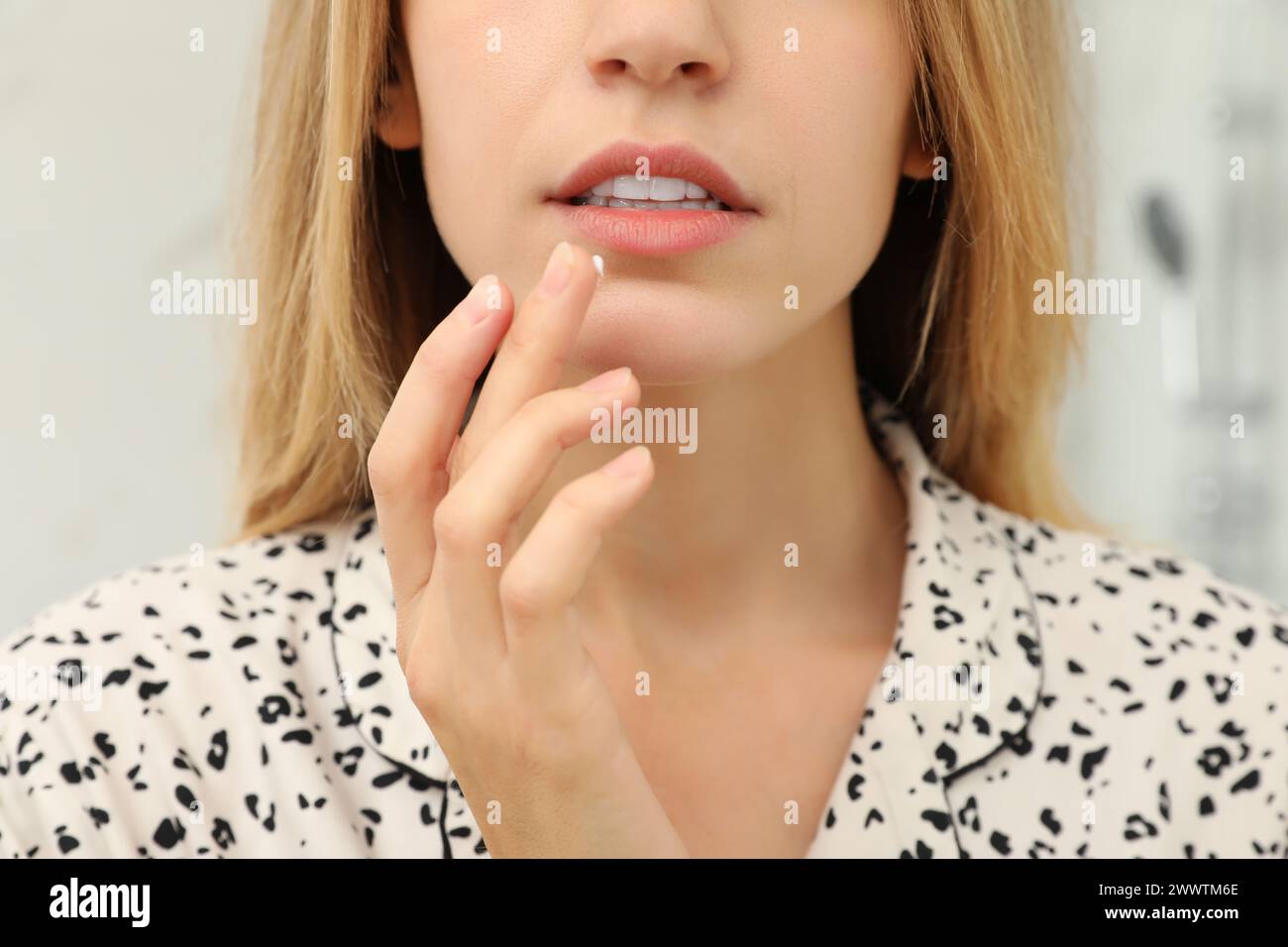 Woman with herpes applying cream onto lip against blurred background, closeup Stock Photo