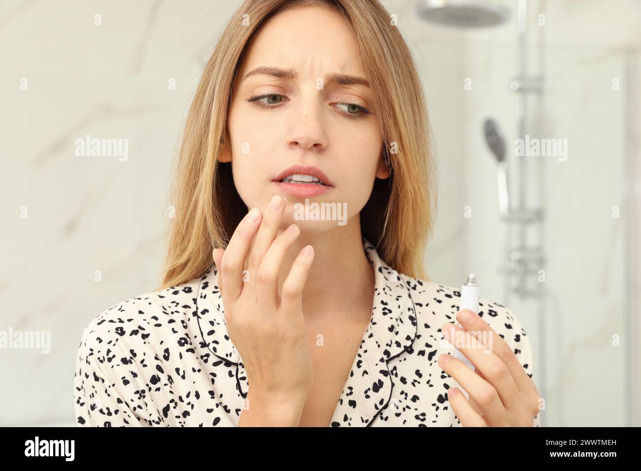 Woman with herpes applying cream onto lip in bathroom Stock Photo