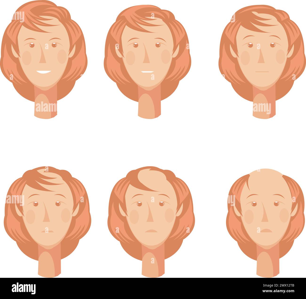 Hair loss storyboard composition of six isolated full faces of balding woman character at various points vector illustration Stock Vector