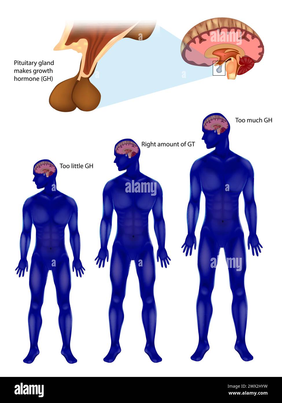 Endocrine regulation of growth. Pituitary gland makes growth hormone GH ...