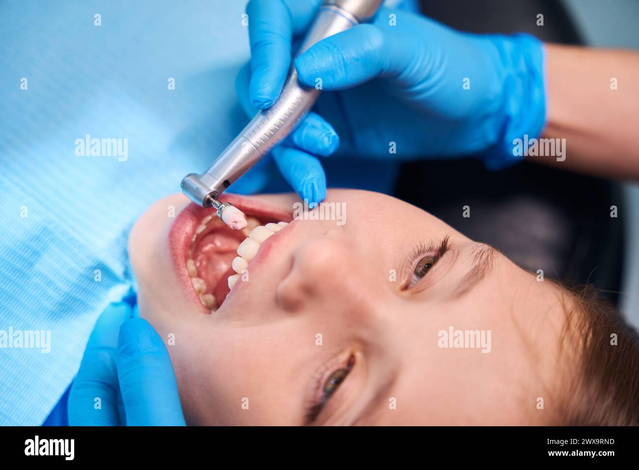 Polishing the teeth of a teenage girl Stock Photo