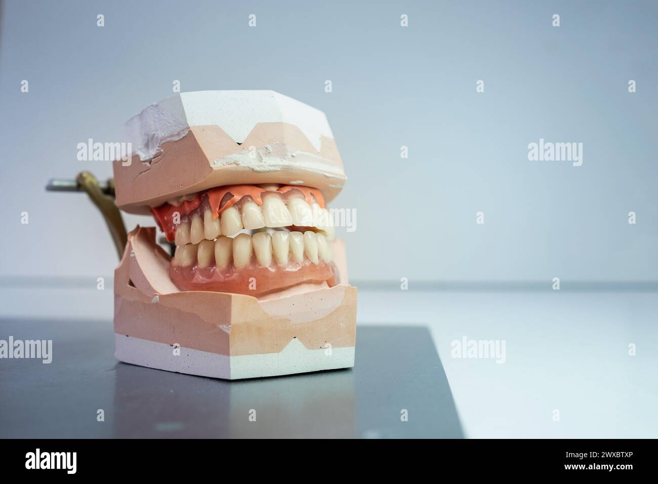 a denture model on a laboratory table. It is the upper and lower jaw. Stock Photo
