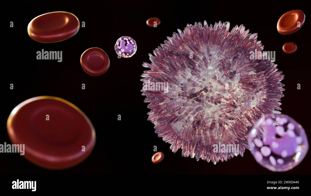 3d rendering of Hairy cell leukemia (HCL) is a rare type of chronic leukemia that develops slowly from white blood cells called B lymphocytes. Stock Photo