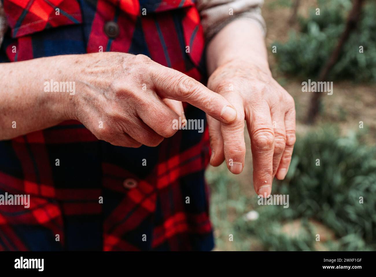 Elderly woman showing her hands joints Stock Photo