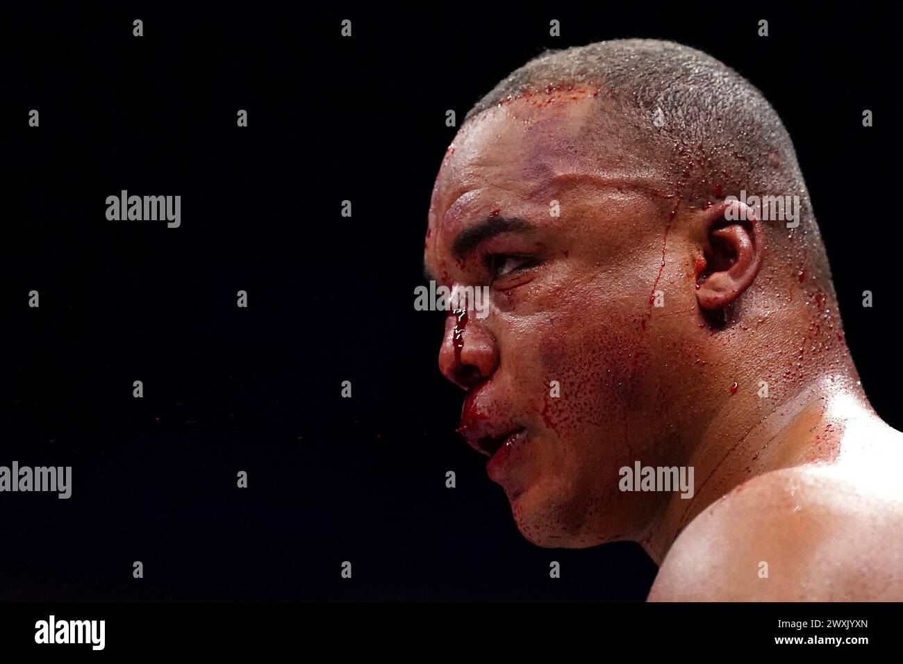 Fabio Wardley in action against Frazer Clarke (not pictured) during ...