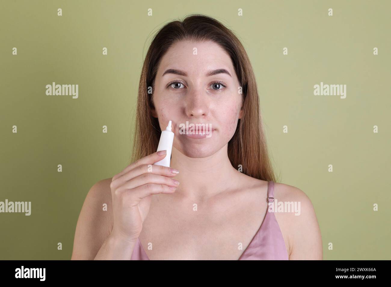 Young woman with acne problem applying cosmetic product onto her skin on olive background Stock Photo