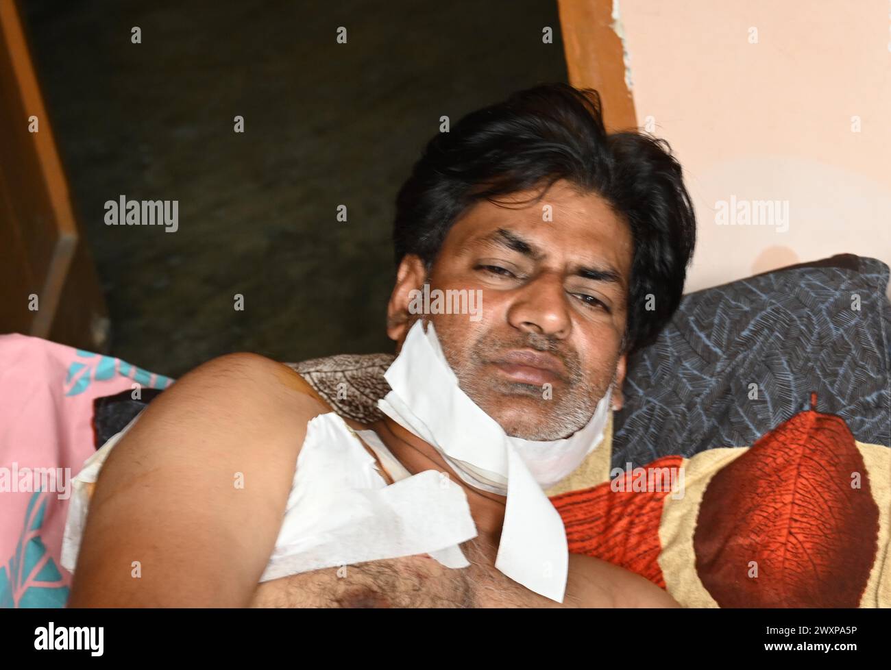 NEW DELHI, INDIA - APRIL 1: Injured Nishu after Leopard attacked at Jagatpur Village near Wazirabad on April 1, 2024 in New Delhi, India. At least five people were injured when a leopard wandered into a village in north Delhi’s Wazirabad on Monday morning, causing panic among the locals. Officials said the leopard was rescued afterwards. (Photo by Arvind Yadav/Hindustan Times/Sipa USA ) Stock Photo
