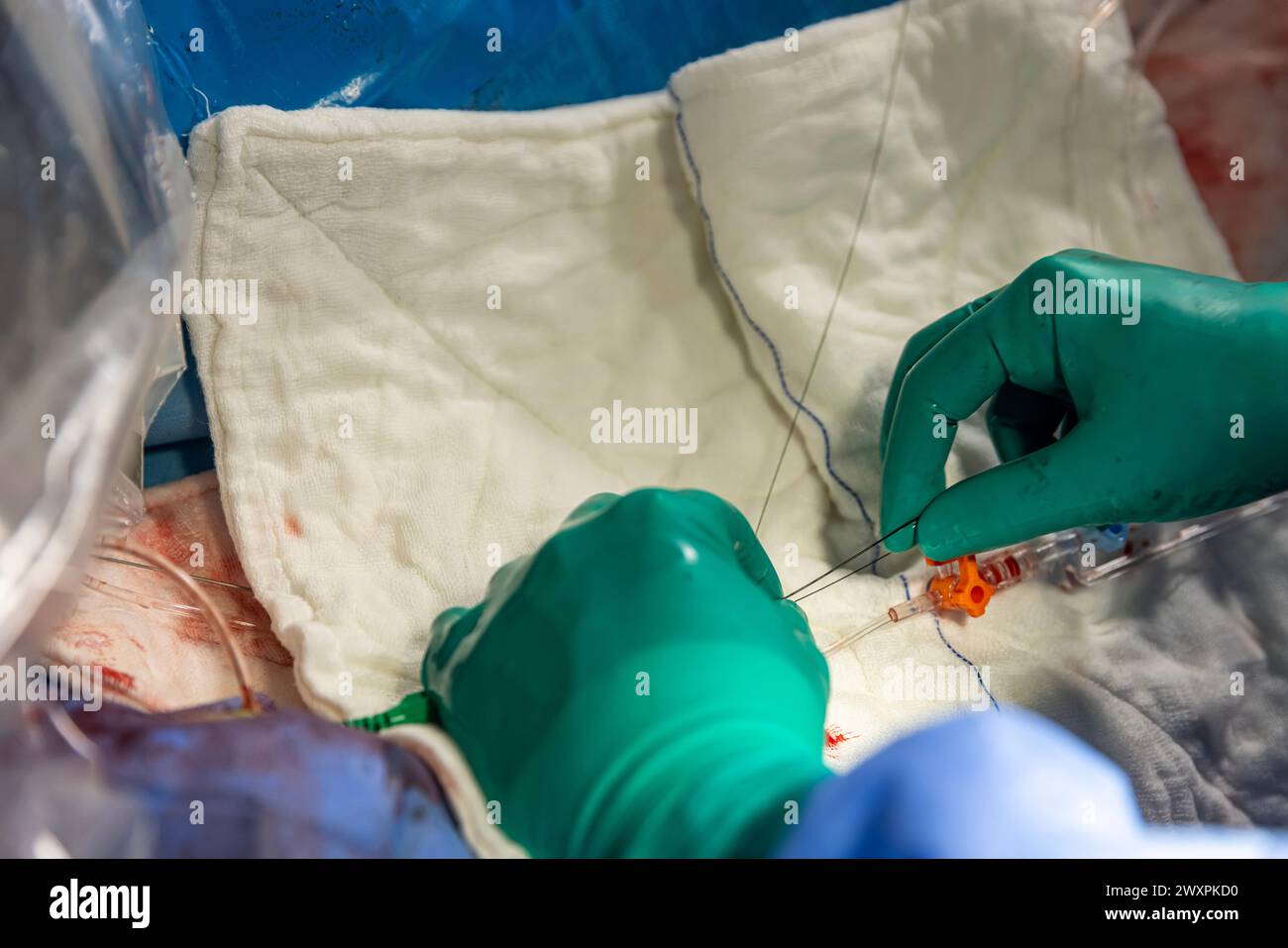 Heart stent placement process in operating room. Heart doctor inserting