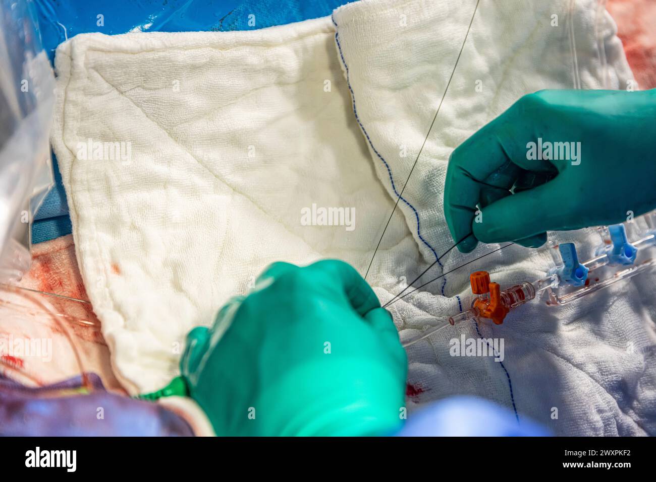 Heart stent placement process in operating room. Heart doctor inserting