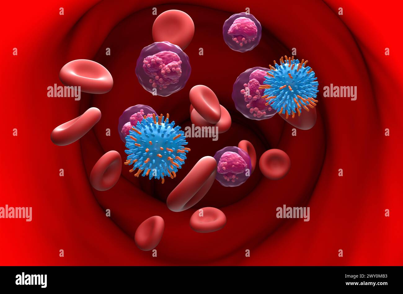 CAR T cell therapy in Acute Lymphocytic Leukemia (ALL) - section view 3d illustration Stock Photo