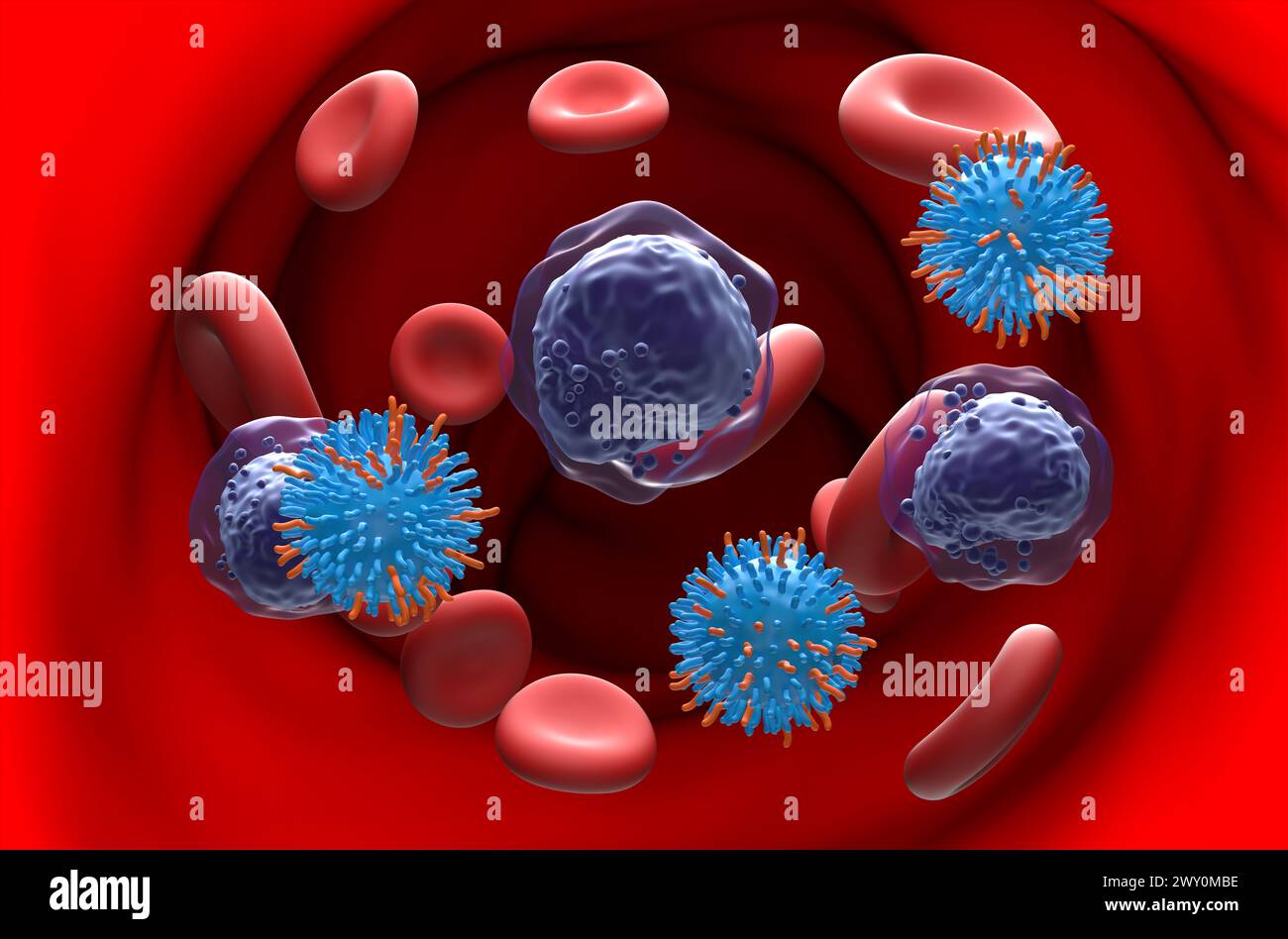 CAR T cell therapy in Acute myeloid leukaemia (AML) - section view 3d illustration Stock Photo