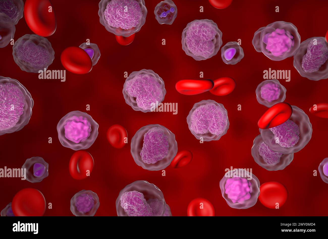 Non-hodgkin lymphoma (NHL) cells in the blood flow - isometric view 3d illustration Stock Photo