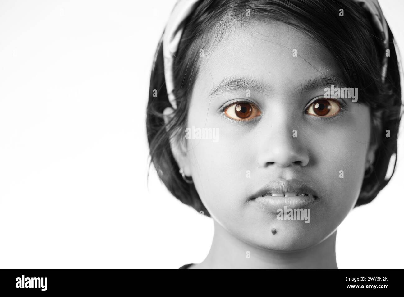 Close up monochrome view of yellow reddish eye of an Indian girl child