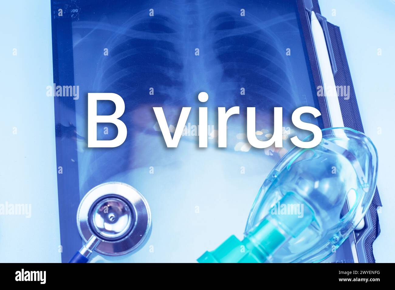 B Virus,herpes B, monkey B virus, Herpesvirus simiae,Herpes virus B