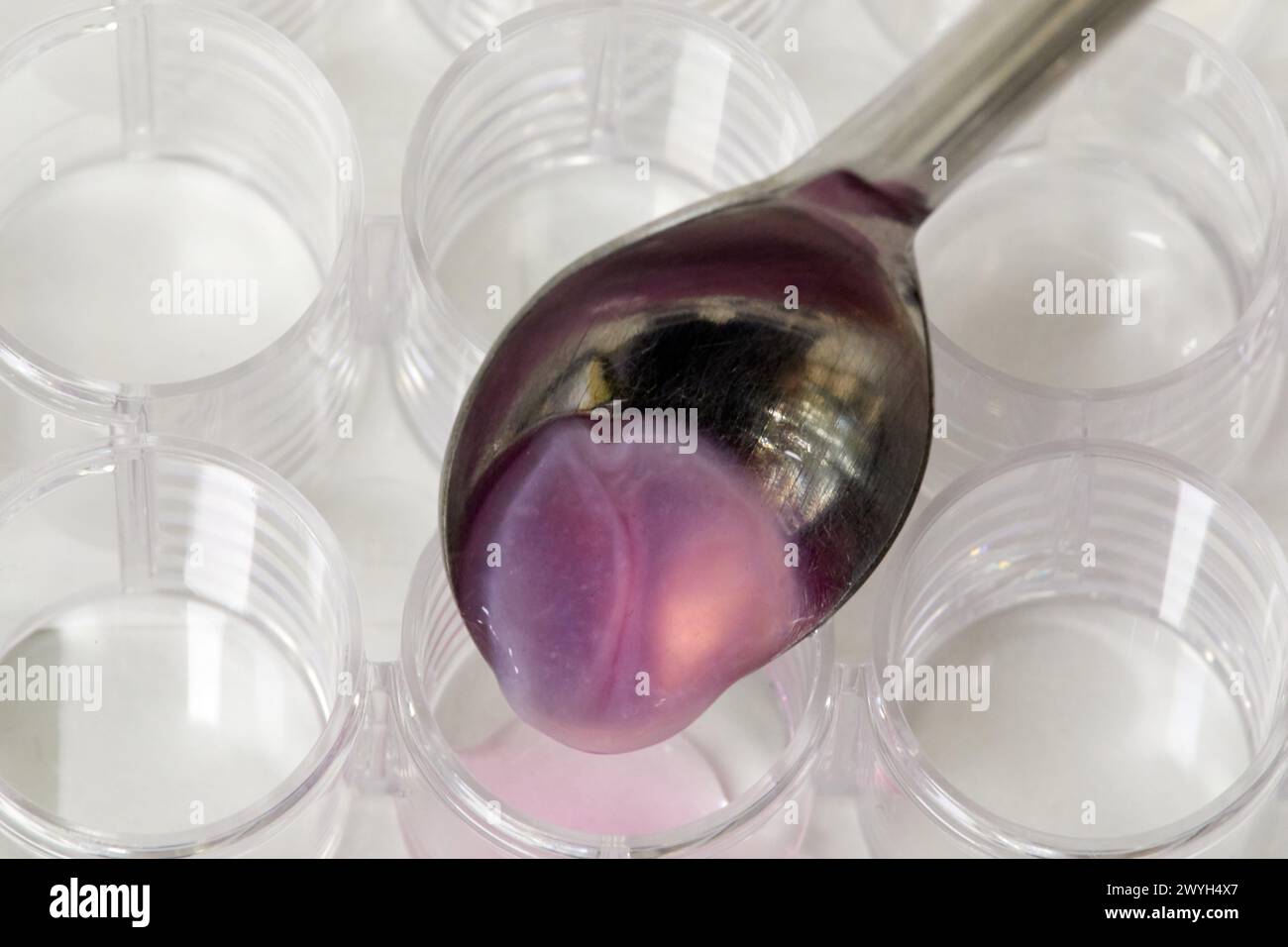 Fatrix FATRIX, Decellularized regenerative matrix oriented to the treatment of ...
