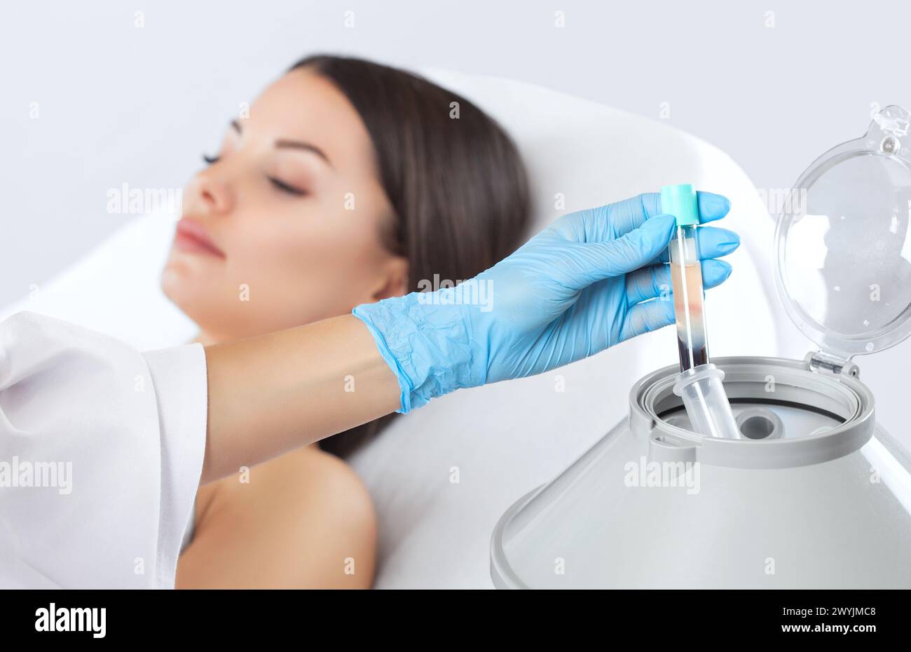 The blood tube is removed from the medical centrifuge for plasma lifting. Prp procedure. Stock Photo